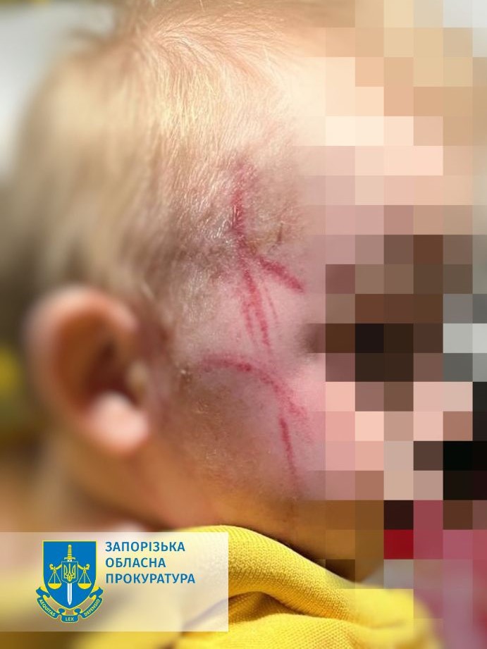Побила однорічного сина за капризи під час купання – повідомлено про підозру жительці Запоріжжя